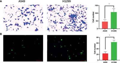 Exosomal lncRNA LINC01356 Derived From Brain Metastatic Nonsmall-Cell Lung Cancer Cells Remodels the Blood–Brain Barrier